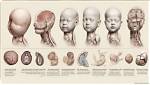 A Comprehensive Guide to Preserving Fetal Remains