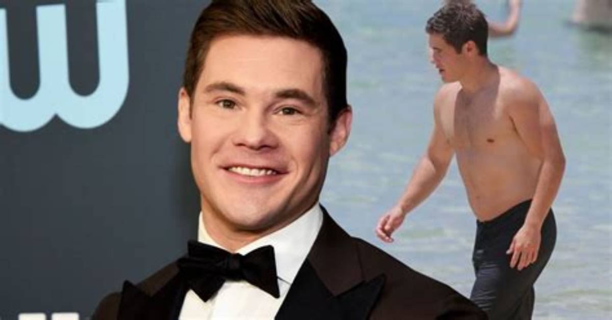 Adam Devine and His Leg Scars: the Untold Story