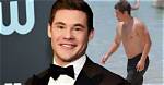 Adam Devine and His Leg Scars: the Untold Story