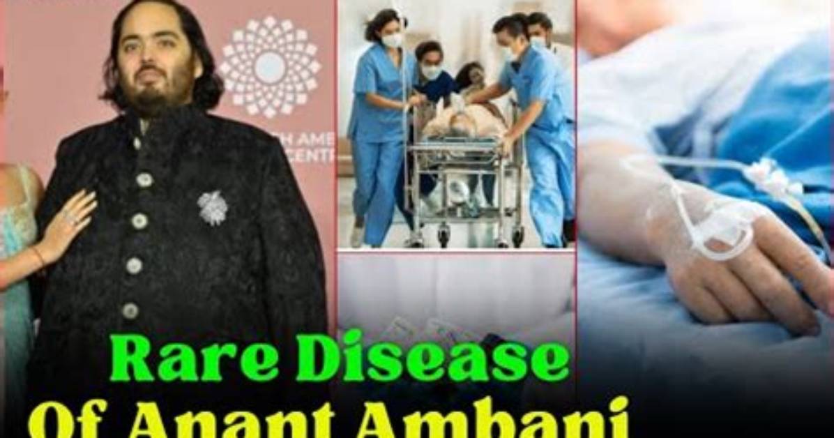 Anant Ambani's Mental Health: What You Need to Know