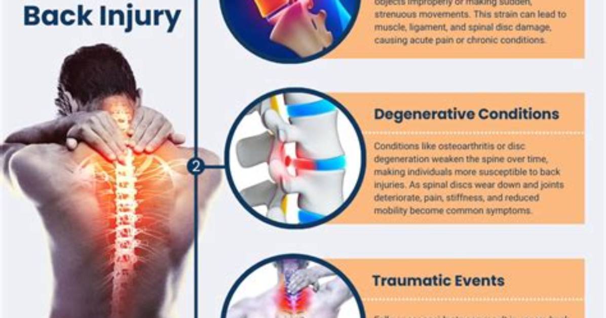 Causes, Symptoms, and Treatment for Back Injury