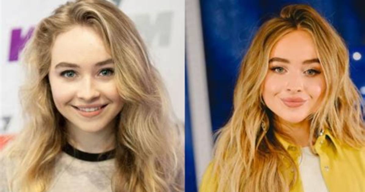 Did Sabrina Carpenter Enhance Her Lips? Get the Truth