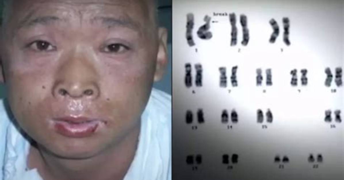 Discover Hisashi Ouchi's Skin Pictures: a Photographic Journey