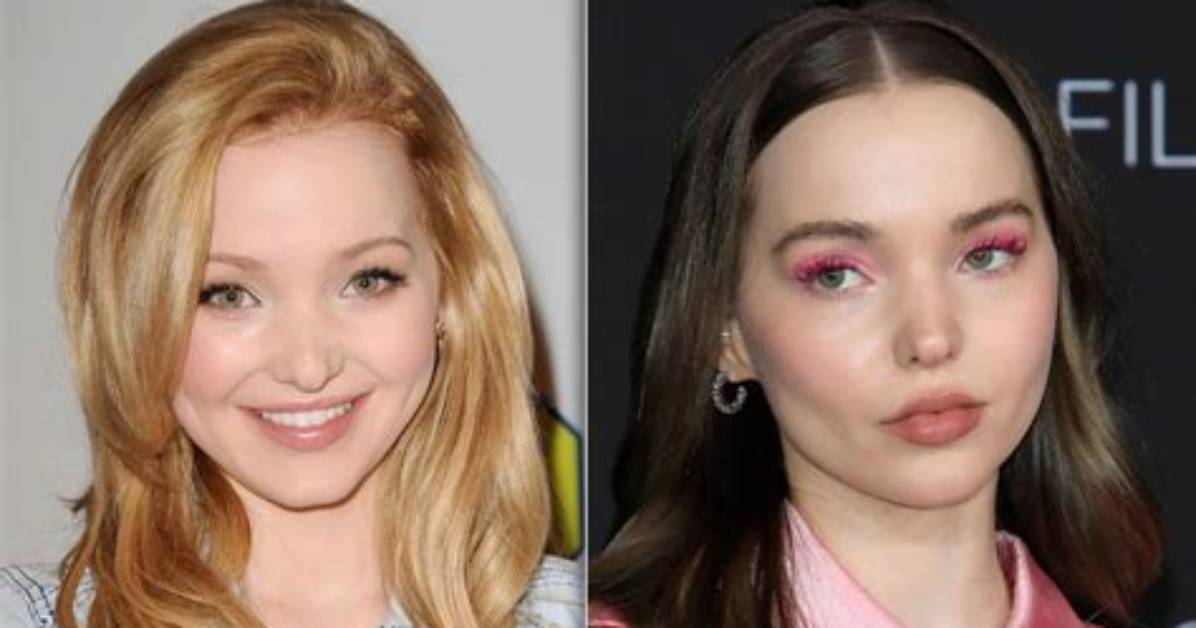 Dove Cameron Weight Loss Reason; Before and After Photos