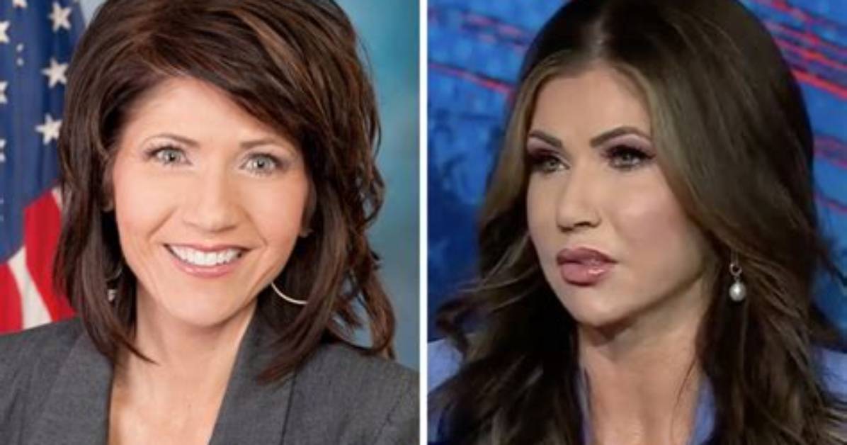 Exploring the Transformation: Kristi Noem's Face Change