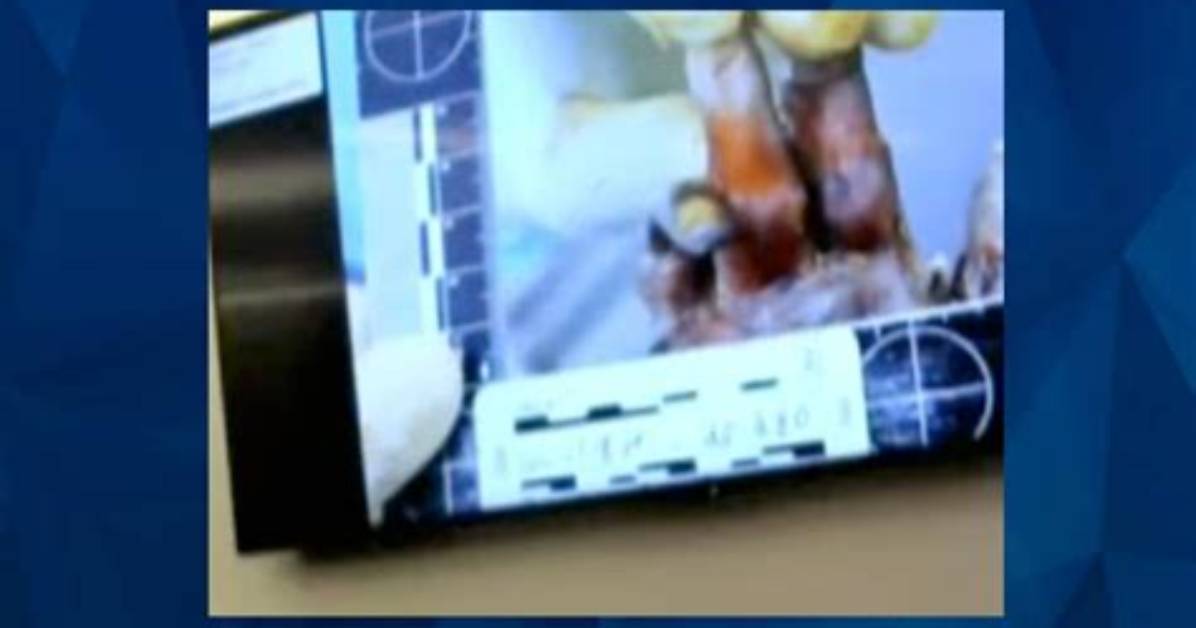 Gannon Stauch Autopsy Photos Leak: Uncovering the Truth