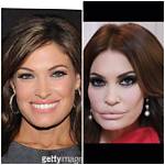 Guilfoyle Before Plastic Surgery: a Glimpse into Transformation