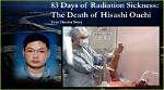 Hisashi Ouchi: a Chilling Tale of Survival and Resilience