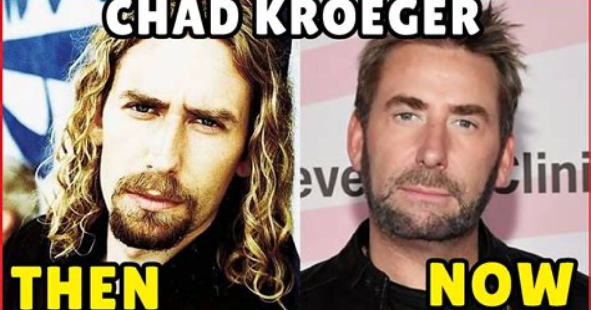 How Old Is Chad Kruger? Uncover His Age
