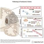 How Stroke's Impact Led to His Untimely Demise
