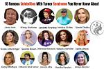 Inspiring Lives: Turner Syndrome Celebrities Who Redefine Beauty