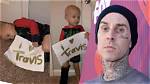 Is Travis Barker Suffering from Bowel Cancer? Update on Health as Alabama’s Daughter Posts Images from the Hospital