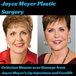 Joyce Meyer's Plastic Surgery Journey and Its Impact