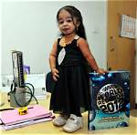Jyoti Amge Afflicted by the Rarest Disease