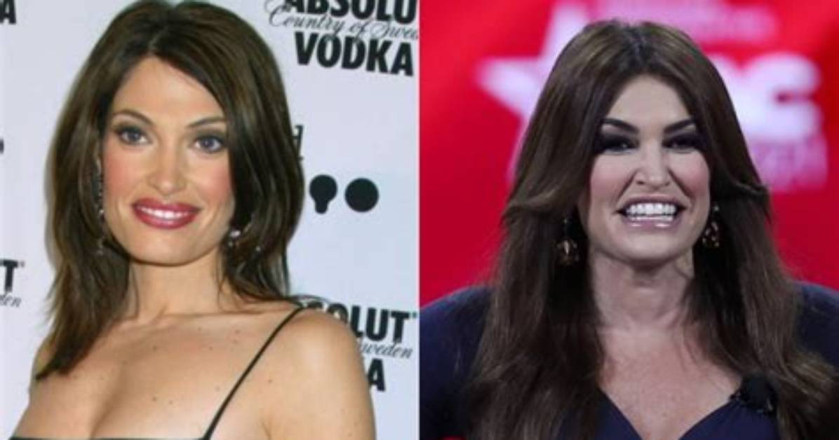 Kimberly Guilfoyle's Plastic Surgery: a Comprehensive Guide