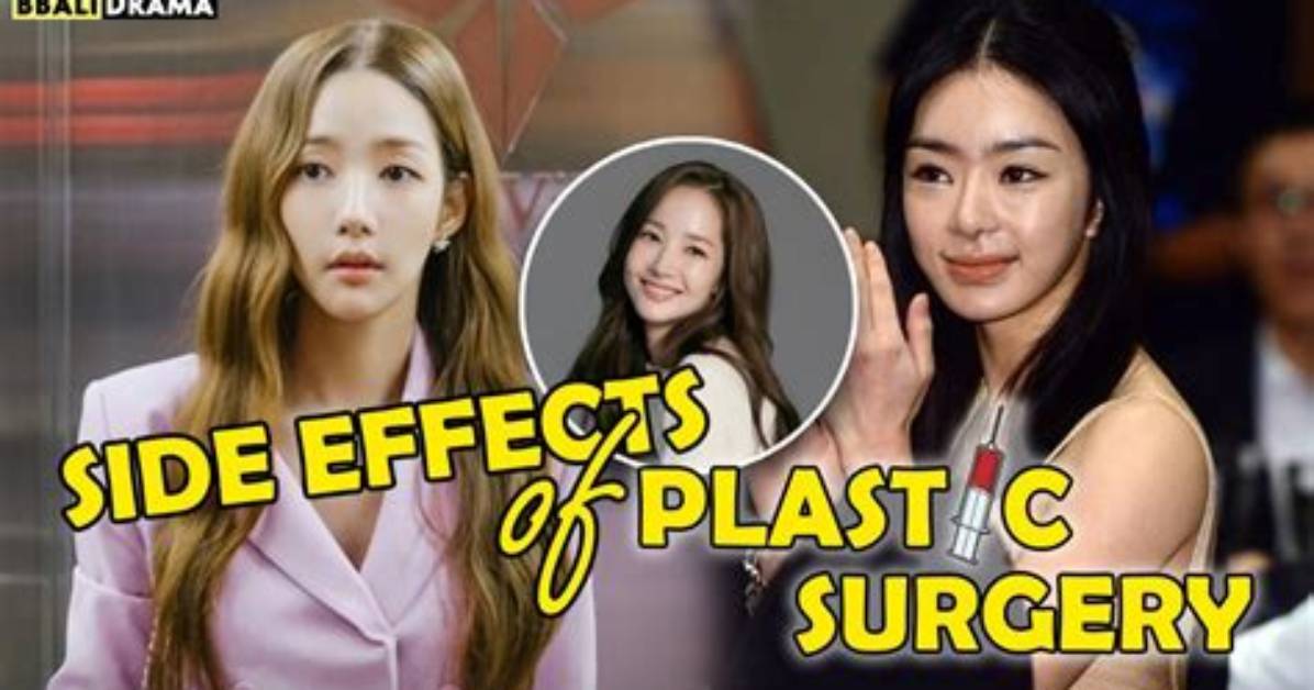 Korean Actors Who Embrace Plastic Surgery: a Closer Look