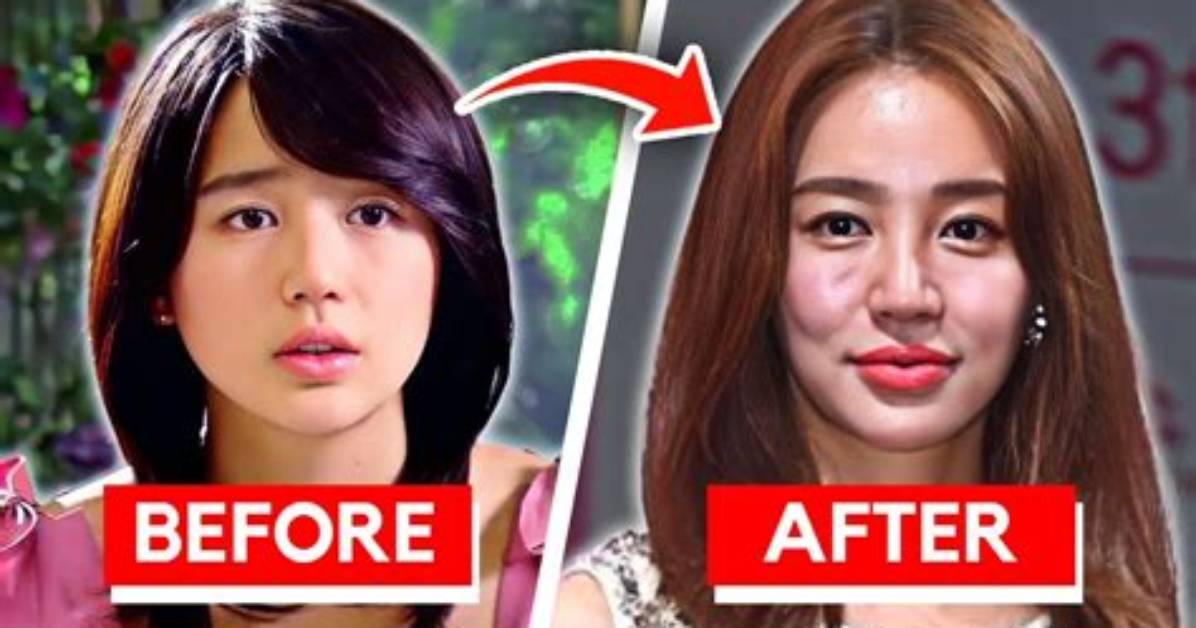 Korean Actresses Who Embraced Plastic Surgery: Transformations and Impact