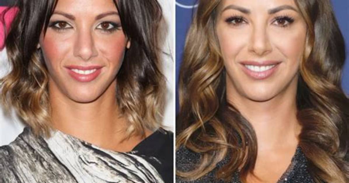 Kristen Doute's Rumored Implant Journey
