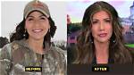 Kristi Noem: a Journey of Transformation - Before and After Plastic Surgery
