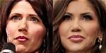Kristi Noem's Cosmetic Surgery Journey Unraveled
