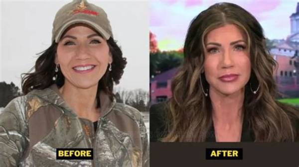 Kristi Noem's Transformation: Before and After Revealed