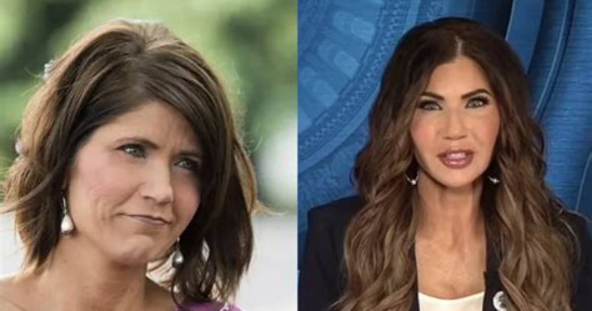 Kristy Noem's Plastic Surgery Journey Explored