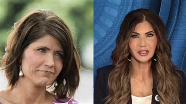 Kristy Noem's Plastic Surgery Journey Explored