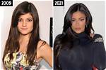 Kylie Jenner's Body Transformation: a Look Ahead to 2024