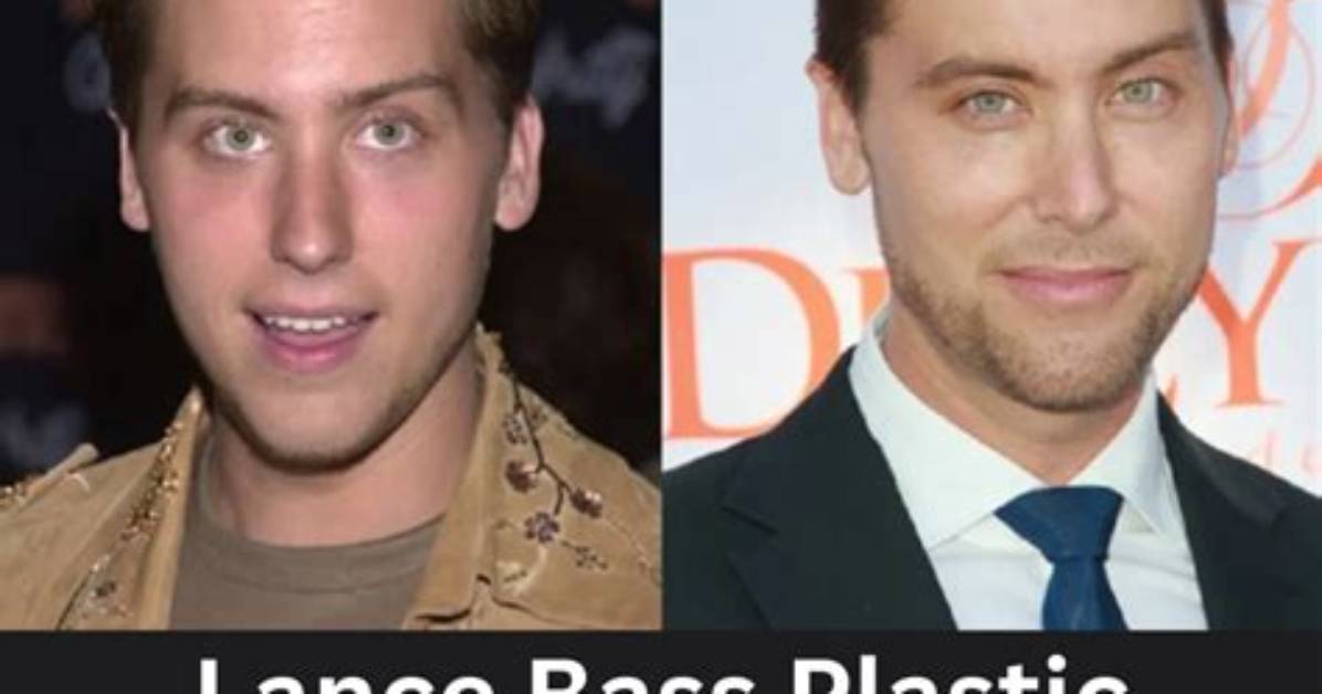 Lance Bass and His Journey Through Plastic Surgery