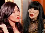 Lyn May and Her Journey with Botox: a Look at Beauty and Transformation