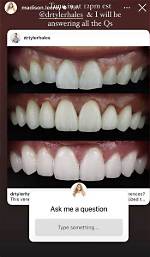 Madison Lecroy Teeth Before: Has She Used Braces and Whitening