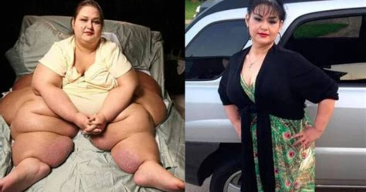 Mayra Rosales Weight Loss Journey: an Inspiring Transformation