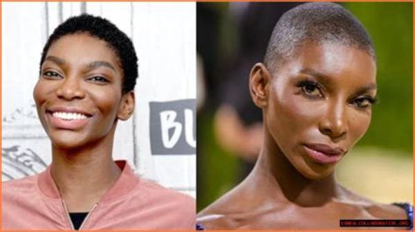 Michaela Coel's Journey: Exploring Fibroids and Recovery