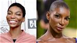 Michaela Coel's Plastic Surgery Journey
