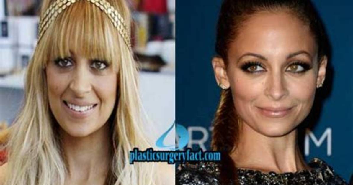 Nicole Richie: a Stunning Transformation - Before and After