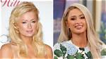 Paris Hilton's Cosmetic Enhancements: a Detailed Guide to Her Fillers