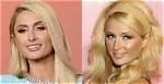Paris Hilton's Cosmetic Enhancements: Unraveling the Plastic Surgery Journey