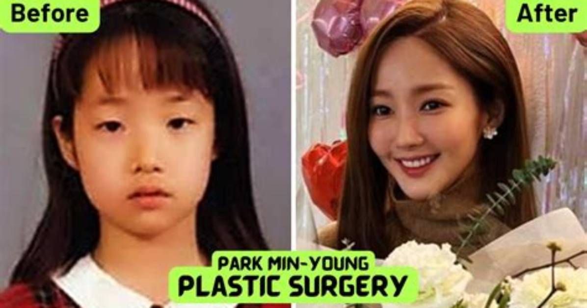 Park Min Young's Transformation: Before and After Surgery