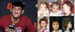 Raul Rosas Jr.'s Unusual Facial Condition: a Medical Mystery