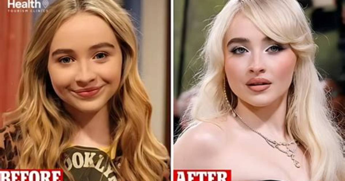 Sabrina Carpenter's Plastic Surgery: the Truth Uncovered
