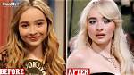 Sabrina Carpenter's Plastic Surgery: the Truth Uncovered