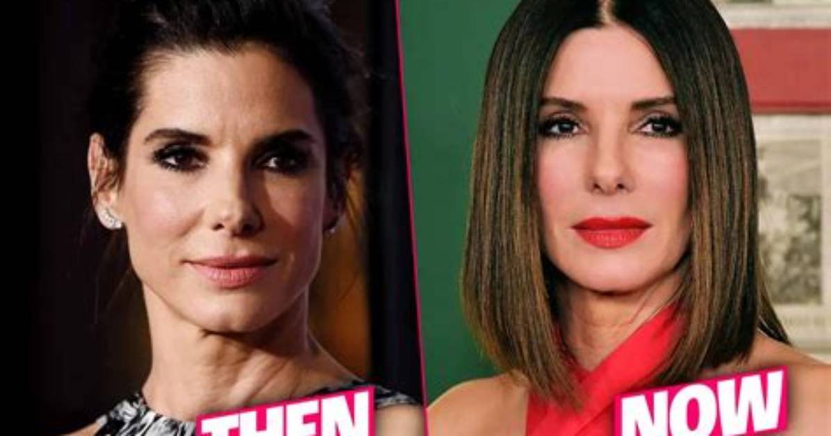 Sandra Bullock's Plastic Surgery: Unveiling the Truth