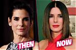 Sandra Bullock's Plastic Surgery: Unveiling the Truth