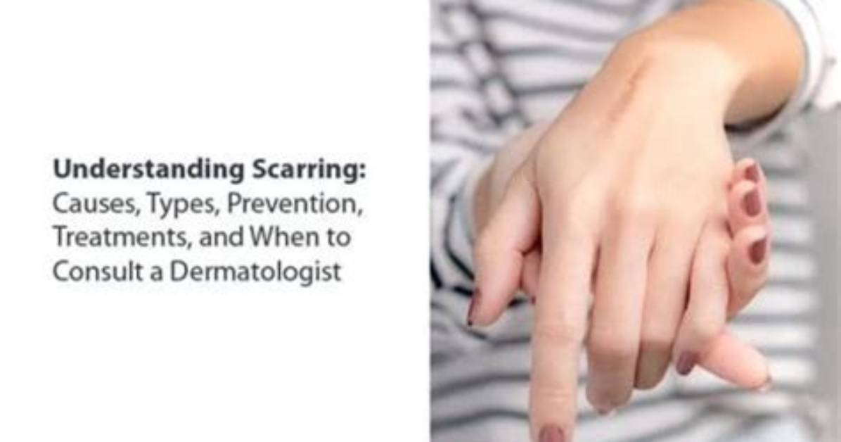 Seal Scarring: Causes, Treatment, and Prevention
