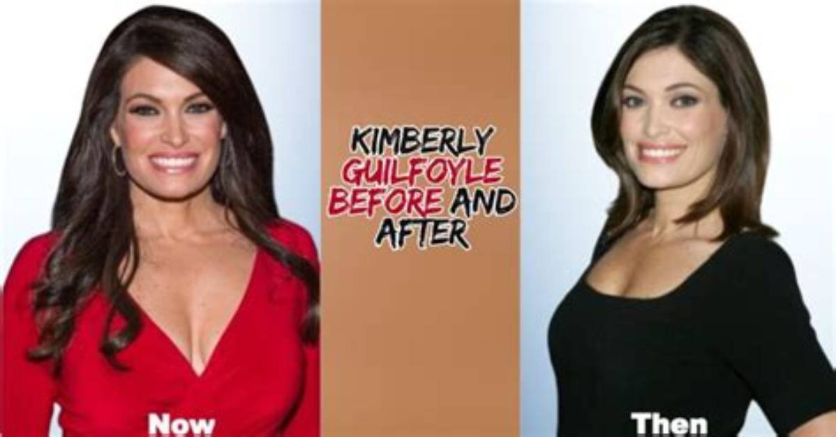 The Complete Guide to Kimberly Guilfoyle's Cosmetic Procedures
