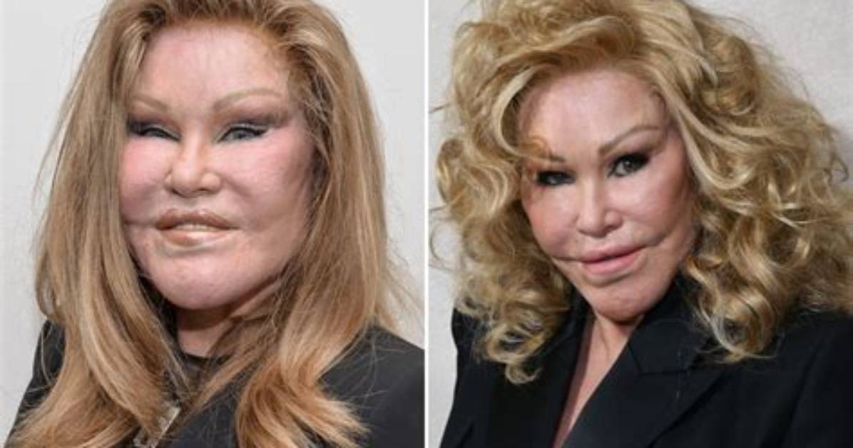 The Enigmatic Transformation of Jocelyn Wildenstein: a Journey of Excess and Controversy