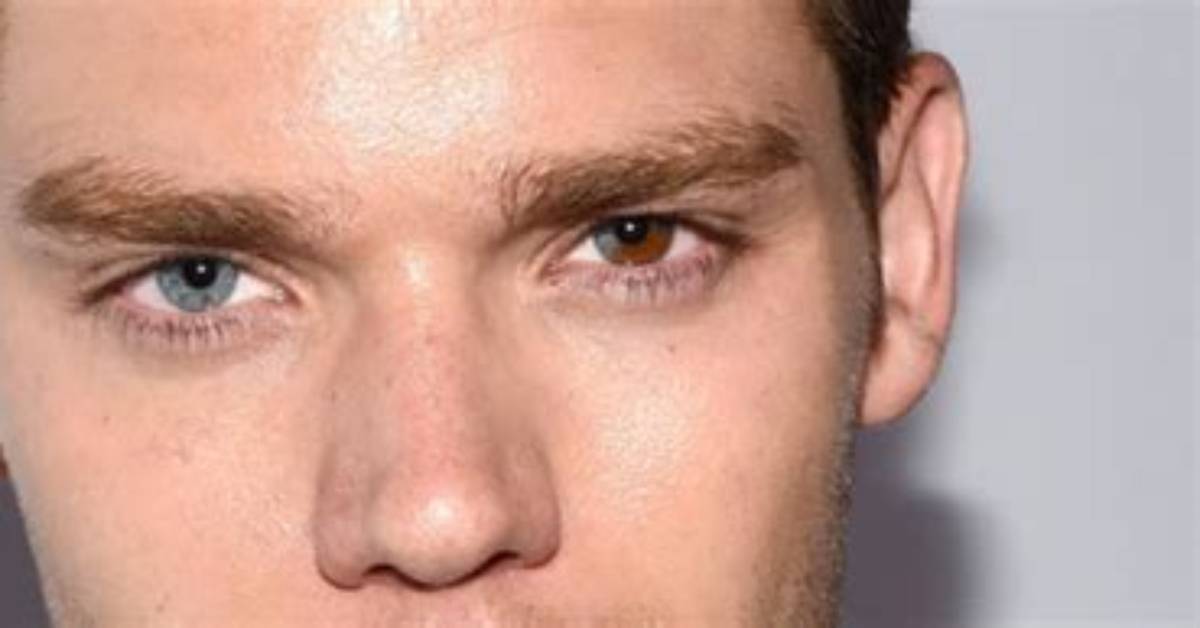 The Hidden Truth About Dominic Sherwood Eyes, Is Different Colored Pupils a Condition?