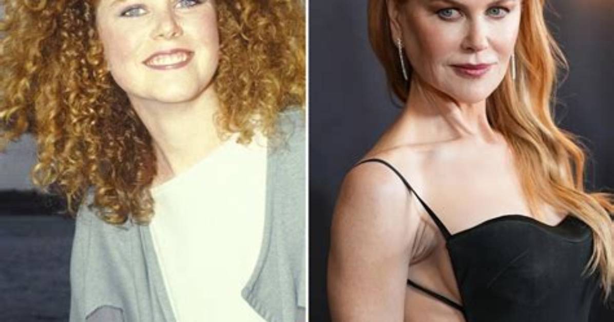 The Surprising Evolution of Nicole Kidman's Look: Botox or Natural Beauty?