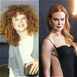 The Surprising Evolution of Nicole Kidman's Look: Botox or Natural Beauty?