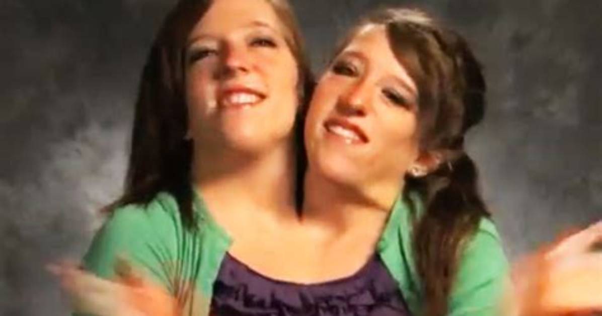 Tragic Loss: the Story of Conjoined Twins Brittany and Abby
